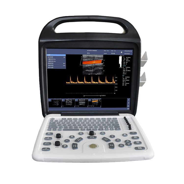 便携式彩超机 现代医疗诊断的革命性工具