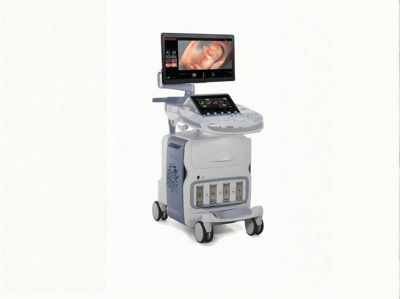 GE彩超最新机型 从无锡基地走出的智能超声设备